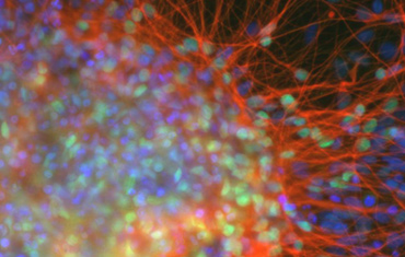 Are You a Candidate for Stem Cell Therapy?