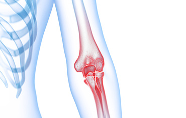 Ask Dr. Van Thiel: How do I Relieve Elbow and Knee Pain?